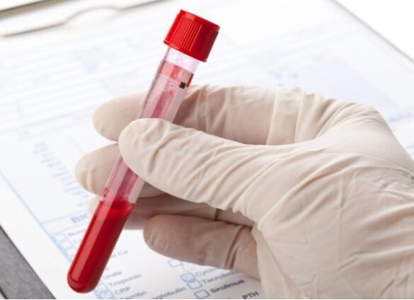 Laboratoriumdiagnostische methoden stellen u in staat om pathologische microflora of virus te identificeren
